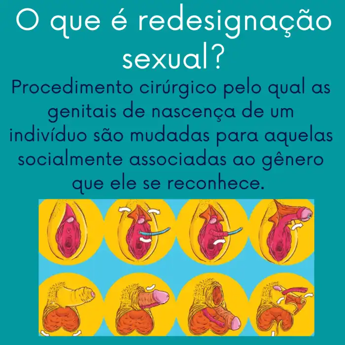CIRURGIA DE REDESIGNAÇÃO SEXUAL - Fisioterapia CIRURGIA DE REDESIGNAÇÃO SEXUAL - Fisioterapia