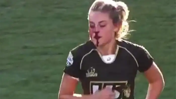 Is it easy to get hurt in rugby?