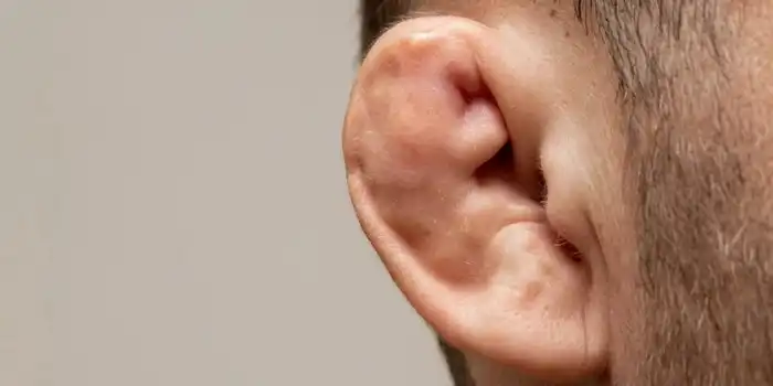 Ear cauliflower treatments Does cauliflower ear affect hearing?
