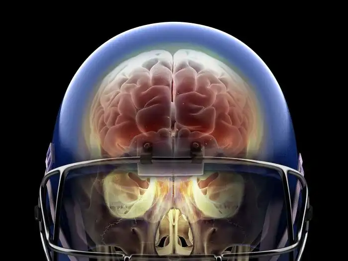 What sport has the most traumatic brain injuries?