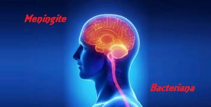 Meningite Bacteriana