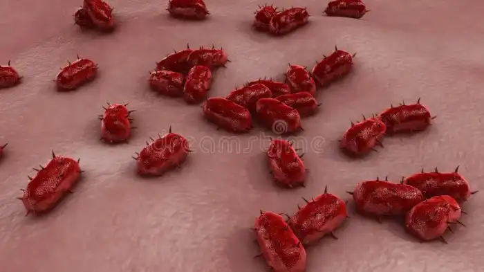 Meningite bacteriana imagem de stock. Imagem de bactérias - 84219853 Meningite bacteriana imagem de stock. Imagem de bactérias - 84219853