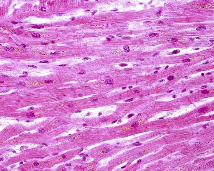 Tipos de músculos - liso, estriado e cardíaco - Biologia - InfoEscola Podemos Considerar Sobre O Músculo Estriado Cardíaco