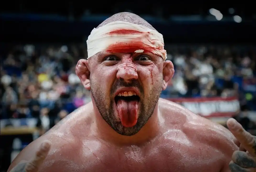 How do humans get cauliflower ear?