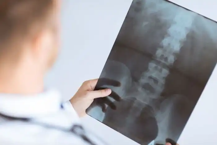 Urografia - co to jest i jak wygląda przygotowanie? Urografia