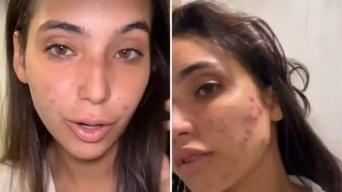 Foto Do Resultado Da Cirurgia Da Mae Da Vanessa Lopes