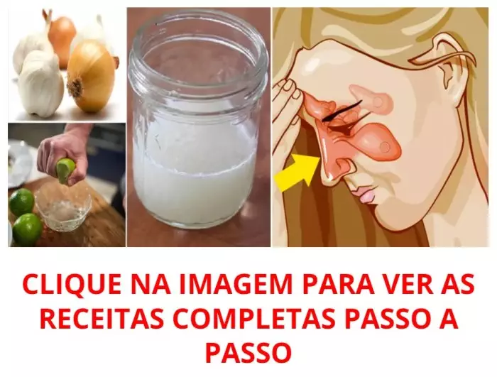 3 Remédios Caseiros Para Sinusite! MELHORES RECEITAS! – Incríveis Dicas ... 3 Remédios Caseiros Para Sinusite! MELHORES RECEITAS! – Incríveis Dicas ...