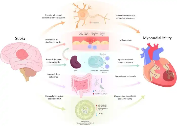 Does rugby cause brain damage